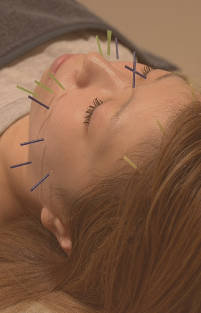 鍼灸